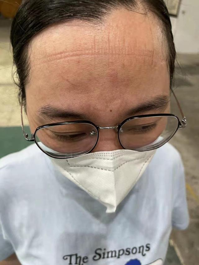 清晨突围战来临；勒沃库森围绕荷甲复出首秀；球迷炸锅；医务组通报恢复